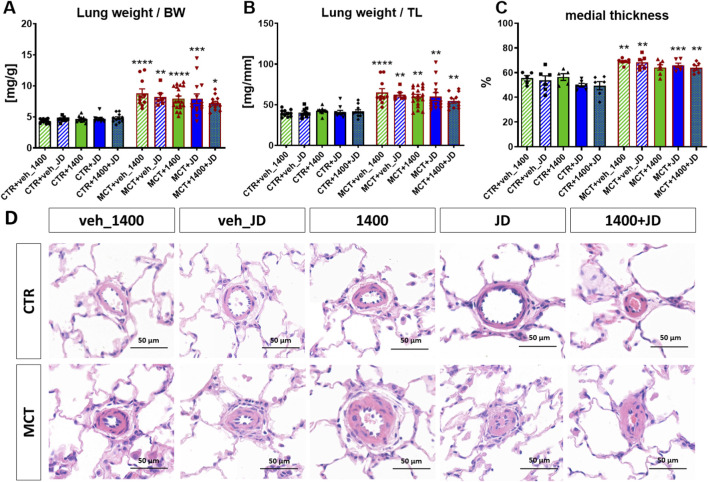 Panels A-C show bar graphs of lung weight to body weight, lung weight to tibia length, and percentage of medial thickness of pulmonary arteries across experimental groups in control and MCT-treated animals, with statistical significance marked by asterisks. Panel D contains histological images of pulmonary vessels from each group, with control groups in the top row and MCT groups in the bottom row, highlighting structural differences. Scale bars indicate 50 micrometers.