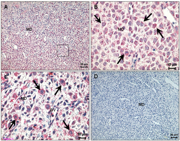 Immunohistochemical demonstration of anandamide-binding receptors expression in uterus on day 10 of pregnancy. (A) CB1 expression in the decidualized cells in the mesometrium pole; (B) Higher magnification of the square indicated in (A) showing positive staining in precursors of uNK cells (arrows); (C) TRPV1 expression in the mesometrial pole in uNK cells (arrows); (D) A negative control for CB1. BV - Blood vessel; MD - Mesometrial decidua.