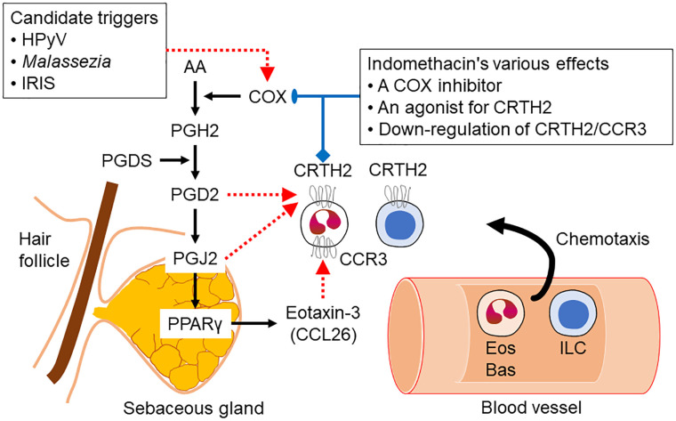 Eosinophilic pustular folliculitis: An unexpected paradigm of sebaceous gland-controlled immunological reaction. Infection with human polyoma virus or Malassezia as well as the immune reconstitution inflammatory syndrome stimulate the arachidonic acid inflammatory pathway in the sebaceous gland. Prostglandins, downstreem arachidonic acid metabolites, attract eosinophils and basophils to the perisebaceous gland dermis. Indomethacin might exhibit its therapeutic effect by inhibiting cyclooxygenase levels or blocking the chemoattractant receptor homologous molecule expressed on Th2 cells and the chemokine receptor 3. HPyV, human polyoma virus; IRIS, immune reconstitution inflammatory syndrome; AA, arachidonic acid; COX, cyclo-oxygenase; PG, prostaglandin; PGDS, PGD synthase; PPARγ, peroxisome proliferator-activated receptor γ; CRTH2, chemoattractant receptor homologous molecule expressed on Th2 cells; CCR3, C-C motif chemokine receptor 3; CCL26, C-C motif chemokine ligand 26; Eos, eosinophil; Bas, basophil; ILC, innate lymphoid cell.