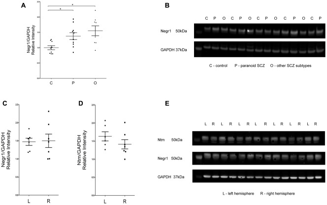 (A,B) Analysis of NEGR1 and representative immunoblots. DLPFC samples were collected from healthy (C, n = 9), paranoid SCZ (P, n = 10) and other SCZ subtype (O, n = 8) patients. (C–E) Analysis of NEGR1 and NTM in the left (L, n = 7) and right hemispheres (R, n = 7), and representative immunoblots. DLPFC samples were collected from healthy patients. Values are means ± SEM. ∗p < 0.05 vs. control.