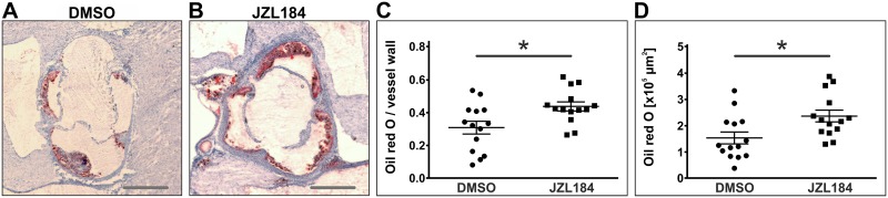 Assessment of atherosclerotic plaque size by oil red O staining.Frozen sections through the aortic sinus of both DMSO-treated control mice and JZL184-treated mice with elevated 2-AG levels were stained using oil red O to visualize atherosclerotic plaques (A, B). Cumulative plaque area was divided by the area of the vessel wall to obtain the relative plaque burden (C). Cumulative plaque areas are depicted in panel D. Data are presented as mean ± standard error of the mean; n = 14; *, p < 0.05, assessed by student’s t-test. Scale bar, 500 μm. DMSO, dimethyl sulfoxide; JZL184, inhibitor of monoacylglycerol lipase.