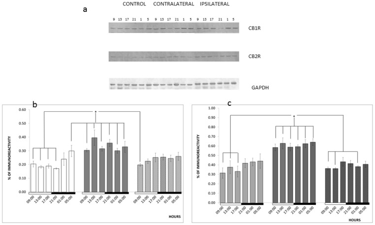 Effects of TBI on CB1R and CB2R expression. (a) Representative picture of a western immunoblot of CB1R, CB2R, and GAPDH in the rat cerebral cortex of rats subjected to TBI at different hours of the day; (b) Quantification by densitometry of the western immunoblot bands for CB1R. The bars represent mean ± SEM of the ratio of the densitometry for CB1R and GAPDH (n = 3); (c) Quantification by densitometry of the western immunoblot bands for CB2R. The bars represent mean ± SEM of the ratio of the densitometry for CB2R and GAPDH (n = 3); * p < 0.05. Two-way ANOVA and a Duncan post-hoc test.