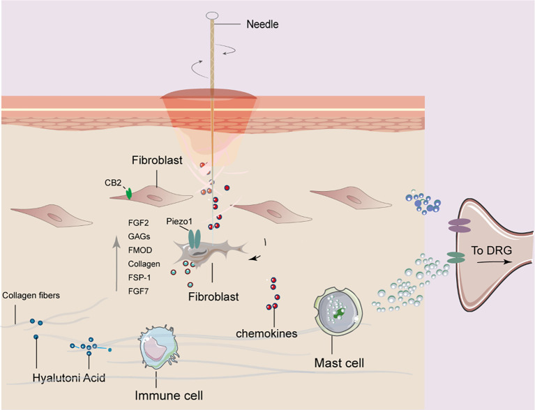 Illustration depicting the interaction of a needle with skin layers, stimulating fibroblasts and fibroblast activation via Piezo1. This results in the production of FGF2, FGF7, and other factors. The process engages collagen fibers, immune cells, chemokines, and mast cells, with signals transmitted to the DRG (dorsal root ganglion).