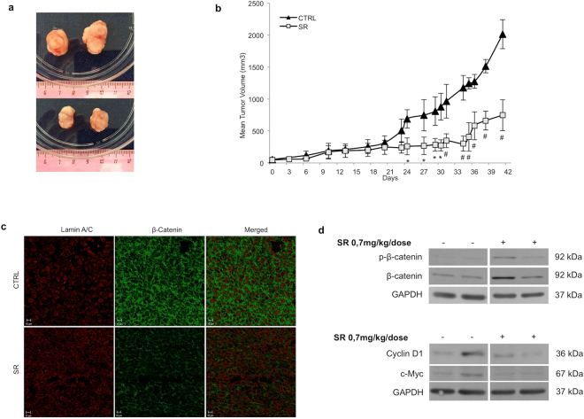SR141716 reduces in vivo tumorigenicity of HCT116 through inhibition of Wnt/β -Catenin canonical pathway. (a) Representative growth of HCT116 xenografts in control (upper panel) and in treated groups (lower panel) at day 42. (b) Tumor volume growth curve after peri-tumoral injection of SR141716. Growth retardation by the compound was statistically significant for all time points labelled with * (one-way ANOVA p < 0.05) or with # (one-way ANOVA p < 0.001). (c) Immunofluorescence staining of HCT116 xenograft tumor sections (10 μm; 42 days from treatment beginning) performed for Lamin A/C (red fluorescence) and β-Catenin (green fluorescence) localization. The image shown represents 3D front view; data are representative of at least three sections from each control and treated tissue sample. (d) Western blot analysis of total and phosphorylated β-Catenin, Cyclin D1 and c-Myc in whole lysate from resected tumor tissues. Cropped blots from full-length gels are displayed in d.