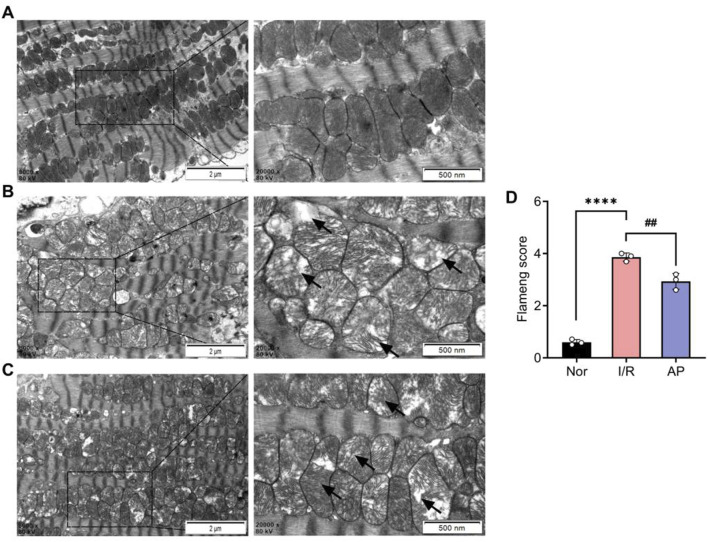 APETx2 post-conditioning improved myocardial cell injury. (A) Ultrastructure of the group Nor myocardial cells under transmission electron microscopy. The morphology of myocardial cells was normal, with oval-shaped mitochondria arranged neatly and uniformly electron-dense. Myofibrils were orderly arranged, with clearly defined dark and light bands, and distinct Z-lines and M-lines (n = 3 per group). (B) Ultrastructure of the group I/R myocardial cells under transmission electron microscopy. The morphology of myocardial cells was significantly abnormal. Many mitochondria were markedly swollen, with reduced or fractured cristae, sparse or vacuolated matrix, and decreased electron density. Myofibrils were disorganized, with indistinct or absent Z-lines and M-lines. Dark and light bands were not distinguishable. Autophagy was observed in the cytoplasm (magnification: X8000, X20000, n = 3 per group). (C) Ultrastructure of the group AP myocardial cells under transmission electron microscopy. The morphology of myocardial cells showed some recovery compared to the group I/R. Mitochondrial swelling was reduced, with increased volume, fewer cristae fractures, and slight matrix dissolution, but decreased electron density. Myofibrils were relatively disorganized, with indistinct Z-lines and M-lines. Autophagy was observed in the cytoplasm (magnification: X8000, X20000, n = 3 per group). (D) Flameng score (n = 3 per group). Flameng scores were lower in the group I/R than in the I/R group Nor (P < 0.0001). Flameng scores were higher in the group AP than in the group (P < 0.01), suggesting that APETx2 post-conditioning can improve myocardial mitochondrial injury. Two-way ANOVA, *P < 0.05; **P < 0.01; ***P < 0.001; ****P < 0.0001. All data are presented as mean ± SEM.