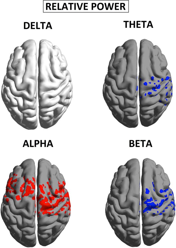 Relative spectral power, during eyes closed. p values of statistical differences in BrainNet viewer source-space between CUD patients and nonuser controls. Red indicates greater power for patients (p < 0.05); blue indicates greater power for controls (p < 0.05)