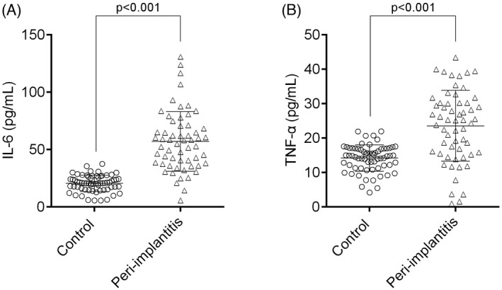 Expression of IL‐6 and TNF‐α between healthy and peri‐implantitis patients in PICF. (A) IL‐6 (B) TNF‐α levels analyze by scatter plots