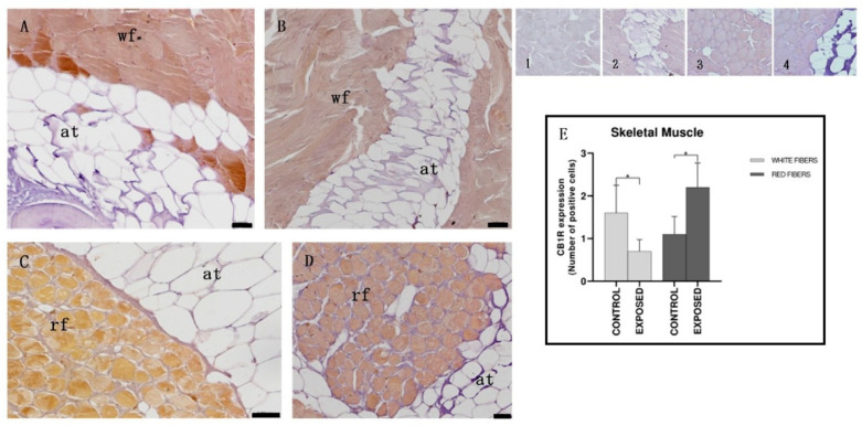 Light micrographs of eel skeletal muscle. Immunoreactivity to CB1R. (A,C): control specimens; (B,D): exposed specimens; (A,B): white fibers; (C,D): red fibers. Insets: 1, 2, 3, 4: negative control of (A–D), respectively. The white fibers (wf) of control specimens (A) appear positive to CB1R, also after cocaine exposure (B), when they show an equal or slightly reduced positivity. The red fibers (rf) appear negative in the control specimens (C) and then become positive for CB1R after exposure to cocaine (D). The adipose tissue (at) appears always negative. Scale bar: (A–D): 0.050 mm. (E): semi-quantitative analysis of immunoreactivity. The Mann–Whitney test showed a statistically significant difference among the control and the exposed specimens (p < 0.05). White fibers of control specimens vs. white fibers of exposed specimens: * p = 0.0476; red fibers of control specimens vs. white fibers of exposed specimens: * p = 0.0238.