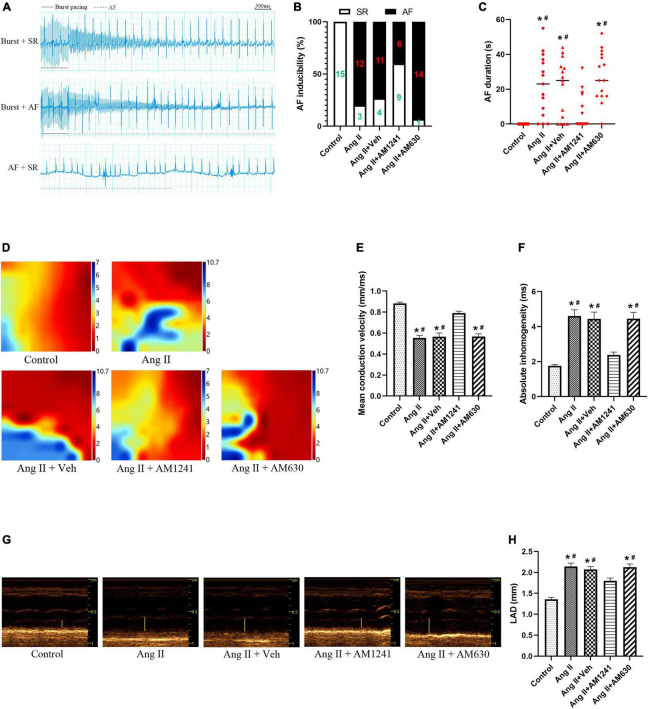 Administration of AM1241 reduced the inducibility of atrial fibrillation (AF) in Angiotensin II-infused mice. (A) Simultaneous recordings of surface electrocardiogram (ECG) after 21-day infusion of Ang II (2,000 ng/kg/min). Solid underlines indicate the burst pacing period, and dashed underlines highlight the AF period. The above two ECGs recorded representative ECG waves of AF and SR after a burst of electrical stimuli. The bottom recorded ECG waves of AF followed by spontaneous conversion to SR. Bar = 300 ms. (B) Inducibility of AF. (C) Duration of AF. (D) Electrophysiological mapping images of spontaneous conduction in the LA. The bars from red to blue indicate the total time from the first to the last measurement within one heartbeat. (E) Mean conduction velocity. (F) Absolute inhomogeneity of left atrial electrical conduction. (G) Representative M-mode echocardiography of the LA. (H) Quantification of LAD. The data represent the mean ± SEM. *P < 0.05 vs. control group. #P < 0.05 vs. Ang II + AM1241 group.