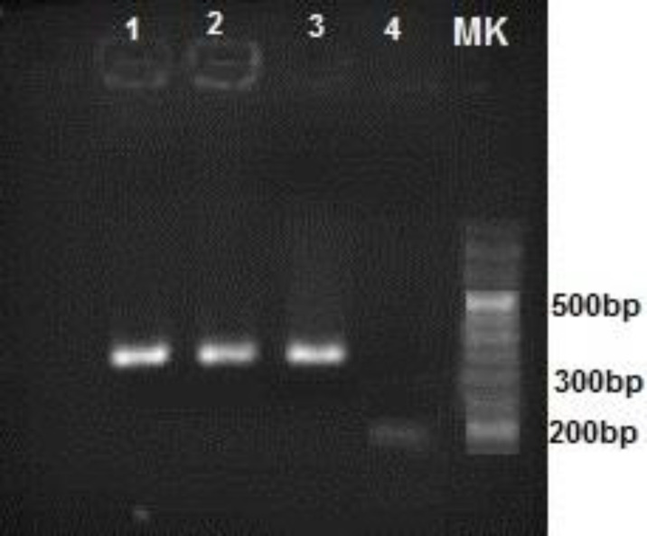 PCR amplification of the B1 gene of T. gondii genome from the brains of infected mice. Lane 1 and 2: positive samples; lane 3: positive control; lane 4: negative control; MK: 50 bp marker.The amplicon size was 321 bp