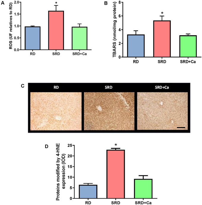 Panel A contains a bar graph comparing ROS levels across three groups: RD, SRD, and SRD plus Ca, with SRD showing the highest values. Panel B shows a similar bar graph for TBARS levels, where the SRD group again exhibits the highest values. Panel C displays three microscopic images of tissue from each group, indicating darker staining in the SRD sample. Panel D presents a bar graph for proteins modified by 4-HNE expression, where the SRD group shows the highest intensity, followed by SRD plus Ca and then RD. Asterisks indicate statistically significant differences.