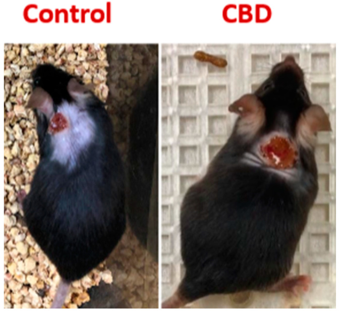 Examples of dorsal wounds in B6 mice showing initial delay in wound closure by contraction with CBD. Please note photographs are not taken with same magnification.