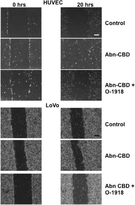 The effects of Abn-CBD treatment on wound healing. HUVEC and LoVo cells were grown to confluence in 6 well plates. Then a scratch wound was made with a pipet tip. Wound area was measured at 0 and 20 h. Scale bar = 100 μm. Abn-CBD treatment accelerated wound healing and O-1918 addition reversed the Abn-CBD effect (see Fig. 7 for detailed results)