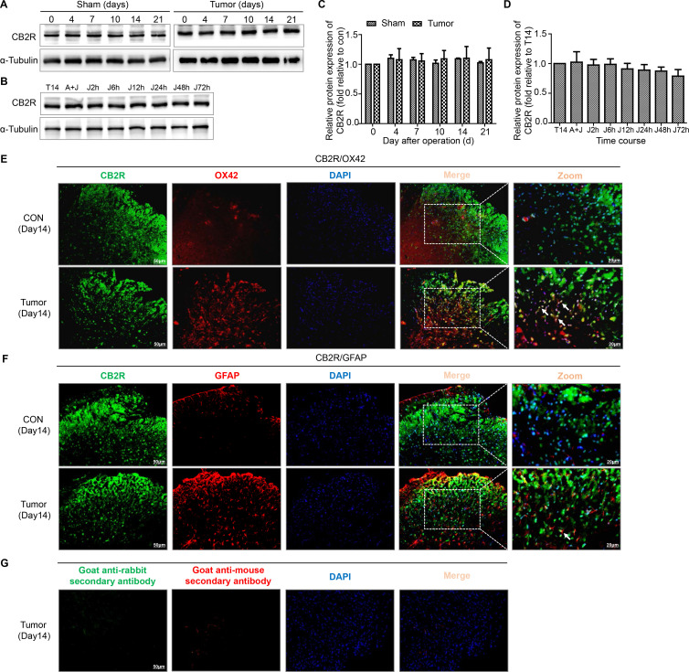 Colocalization of CB2R on microglia and astrocytes in the spinal dorsal horn of BCP mice. (A, C) Representative blots and quantification of CB2R on postoperative days in the sham and tumor groups. n=3 for each time point per group. (B, D) representative blots and quantification of CB2R at 2, 6, 12, 24, 48 and 72 hours after the injection of JWH015 compared with vehicle injection respectively. n=3 for each time point per group. (E) Double immunostaining of CB2R (green) and OX42 (red) in the spinal dorsal horn performing in Con and tumor (day 14) group mice. (F) Double immunostaining of CB2R (green) and GFAP (red) in the spinal dorsal horn performing in Con and tumor (day 14) group mice. Arrows showed the representative merge of CB2R and OX42 or GFAP. (G) Immunofluorescence negative controls. immunostaining of goat anti-rabbit secondary antibody (green) and goat anti-mouse secondary antibody (red) in the ipsilateral spinal dorsal horn of the tumor (day 14) group of mice. Scale bar, 50 µm and 20 µm. All data are presented as the means±SD. BCP, bone cancer pain; CB2R, cannabinoid receptor 2; GFAP, a marker of astrocyte; OX42, a marker of microglia.