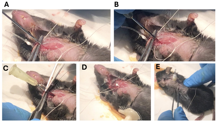 Surgical procedure for intravenous jugular catheterization.Once the jugular vein is located (A), two threads are tied around the vein, using the upper thread to cut the blood supply. Using a 20 G 1½ needle, the vein is punctured (B), the cannula is introduced into the jugular vein (B), and the silicone tube is advanced into the vein (C) until it reaches the catheter’s silicone ball. Then, after checking the catheter entry site, the lower knot is tightened to secure the catheter, and heparin is administered to maintain catheter patency (D). After securing the catheter with a net of sutures, the catheter tulle is placed under the skin, and the skin is sutured over the catheter to fix the tube (E).