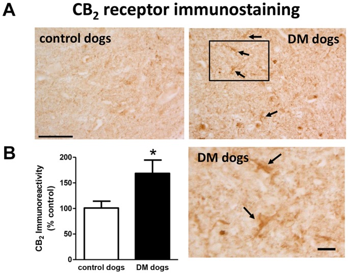 CB2 receptor immunostaining and quantification in DM-affected dogs. Representative photomicrographs for CB2 receptor immunostaining using DAB (A) and its quantification (B) in the grey matter of the ventral horn in T7-T10 spinal cord sections of DM-affected and age-matched control dogs. Values are expressed as means±s.e.m. for 5-6 animals per group. Boxed region in DM dog image is shown enlarged in panel below. Data were analysed using the unpaired Student's t-test (*P<0.05 compared with control animals). Scale bars: 150 µm and 50 µm (enlargement). Arrows indicate CB2 receptor-positive cells.