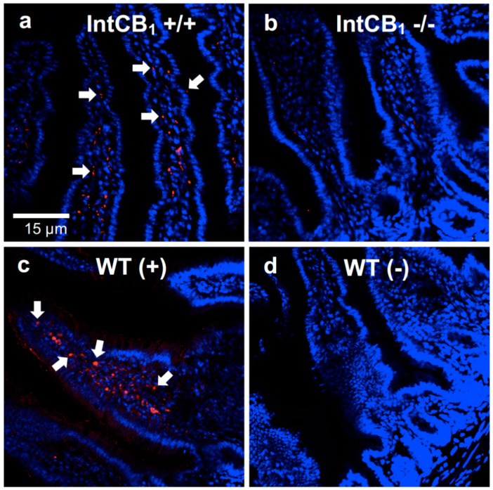 CB1R immunoreactivity is absent in the upper small-intestinal epithelium of conditional intestinal epithelium-specific CB1R-deficient mice. When compared to control mice (a, IntCB +/+), conditional intestinal epithelium-specific CB1R-null mice (b, IntCB1−/−) are deficient in immunoreactivity for CB1Rs in the upper small-intestinal epithelium. Wild-type C57BL/6Tac mice display immunoreactivity for CB1Rs in the upper small-intestinal epithelium (c, WT (+)), which is absent when the primary CB1R antibody is not included (d, WT(-)). White arrows point to representative red immunoreactivity for CB1Rs. Red = CB1R immunoreactivity; blue = DAPI. WT = wild-type mice. (+) = with CB1R primary antibody; (-) = without CB1R primary antibody.