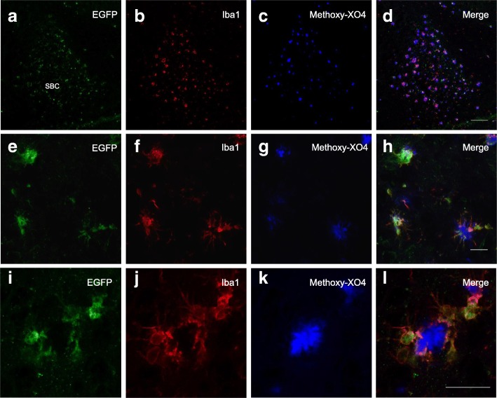 Restricted EGFP expression in microglial cells located in peri-plaque areas of the CB2EGFP/f/f/5xFAD mouse hippocampus. a–l Low-magnification photographs of EGFP+ microglial cells (a, b) in close association to beta-amyloid neuritic plaques (c, d). Medium- (e–h) and high-magnification (i–l) photographs of EGFP+ microglial cells. Detailed co-localization immunofluorescent analysis reveals a complete overlap between EGFP+ cells and Iba1+ cells, indicative of their macrophage/microglia nature, and a selective association to amyloid-enriched plaques (stained with methoxy-XO4). Scale bars, 100 μm (a–d), 25 μm (e–h), and 25 μm (i–l). SBC (subiculum)