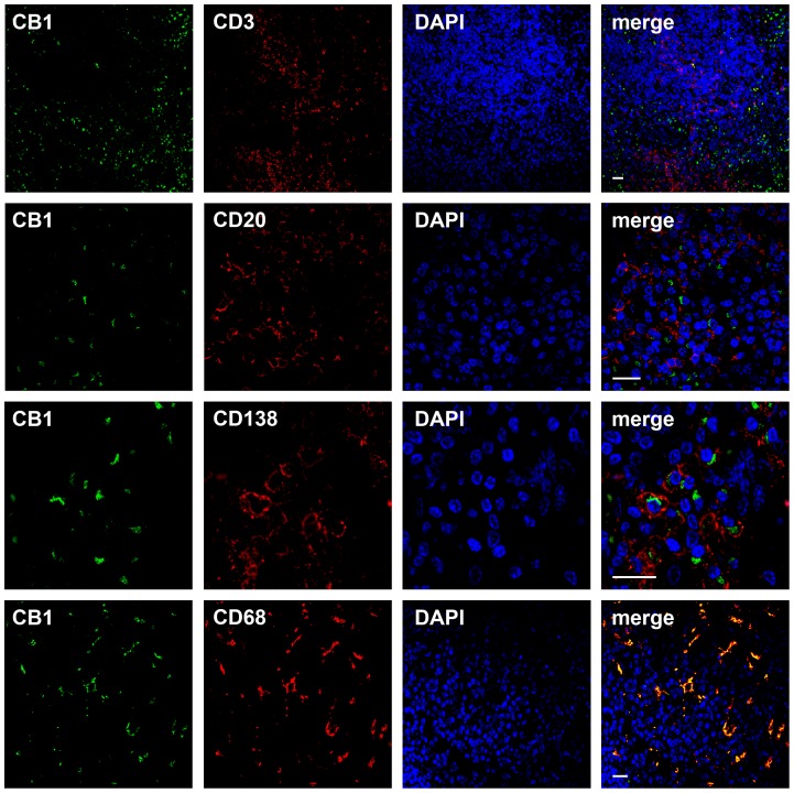 CB1 in reactive lymphoid tissue.Immunofluorescence staining and confocal imaging of a tonsil against CB1–N (green, left column), CD3, CD20, CD138 and CD68 (all in red, second left column). Nuclei were visualized using DAPI (blue, second right column). Right column represents merged images. CB1 signal was present in CD68+ macrophages and CD138+ plasma cells, not in CD3+ and CD20+ lymphocytes. Bars = 20 µm.