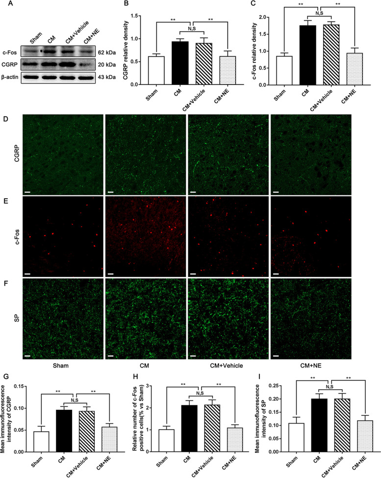 Regulation on central sensitization by NE in CM rats. A Representative western blots of CGRP and c-Fos. B and C. The protein levels of CGRP and c-Fos in the CM group were significantly higher than those in the Sham group, and there was no significant difference between the CM group and CM + Vehicle group. The CGRP and c-Fos expression levels in the CM + NE group were sharply reduced compared with those in the CM + Vehicle group. (n = 6/group, **p < 0.01, N, S, not significant). D-F Immunofluorescence staining of c-Fos, CGRP, and SP in the PAG. G-I The number of c-Fos-positive cells and the average fluorescence intensity of CGRP and SP were substantially higher in the CM group than those in the Sham group, and there was no statistical difference between the CM and CM + Vehicle groups. Compared to the CM + Vehicle group. The number of c-Fos-positive cells and the average fluorescence intensity of CGRP and SP were materially decreased in the CM + NE group. (n = 6/group, **p < 0.01, N,S, not significant, scale bar = 20 μm)