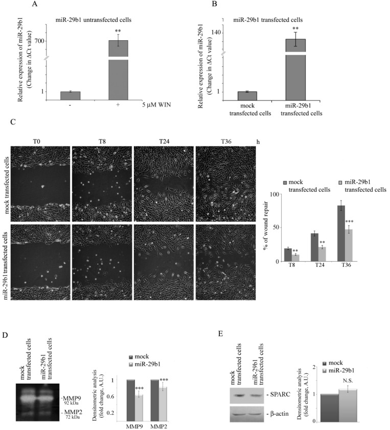 WIN induces a dramatic increase in miR-29b1 expression, and miR-29b1 overexpression reduces cell migration. (A) Gene expression levels of miR-29b1 in untreated or 5 µM WIN-treated cells for 24 h were analysed by RT-qPCR. (**) p < 0.01 compared to untreated cells. (B) Validation of gene expression changes in cells stably transfected with miR-29b1 versus mock transfected cells. The height of each column reflects the ratio of the expression of miR-29b1 compared to U6 (a non-coding small RNA used as a control) (**) p < 0.01 and (***) p < 0.001 compared to the untreated cells at the same time point. (C) Wound healing migration assay of miR-29b1-transfected MG63 cells in comparison with cells transfected with mock alone. Pictures were taken at the indicated time points after wounding (magnification 200×). The average distances between cells at the edges of the gaps in the wound healing assay was estimated through ImageJ software. On the right of the picture, a graph of the mean percentage area healed at T8, T24 and T36 post-wounding is shown. (**) p < 0.01 and (***) p < 0.001 compared to the untreated cells at the same time point. (D) Gelatin zymography of MMP2 and MMP9 in miR-29b1-transfected cells versus mock transfected cells. Arrows indicate the relative bands at 72 kDa (MMP2) and 92 kDa (MMP9). Volumes containing equal amount of proteins were loaded. Densitometry values are averaged from three independent experiments. (***) p < 0.001. (E) Western blotting analysis of SPARC level in miR-29b1 overexpressing cells. The results were obtained by immunoblotting employing a specific SPARC antibody as reported in Section 4. β-actin blot was included as a loading control. Densitometry values are averaged from four independent experiments normalized to β-actin. N.S. not significant.