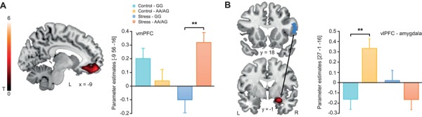 Stress and CNR1 genotype effects on brain activity during affective picture processing. (A) Activity in the vmPFC was increased in rs1049353 AA/AG compared to GG genotype carriers for negative (vs neutral) picture processing under stress. (B) Under no-stress control conditions, the vlPFC showed enhanced functional connectivity with the amygdala when AA/AG compared to GG genotype carriers viewed negative (vs neutral) pictures. Activations are superimposed on coronal sections of a T1-weighted template image and represented in red. vmPFC: ventromedial prefrontal cortex, vlPFC: ventrolateral prefrontal cortex, L corresponds to the left, R to the right side of the brain and error bars represent SEM. **P < 0.01