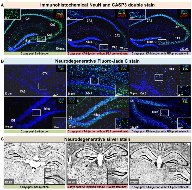 Neurodegenerative and immunohistological staining 5 days post KA-seizure induction. To unravel PEA’s neuroprotective potential neurodegenerative and immunostainings were performed on brain sections sampled 5 days post KA-induced epileptic seizures in mice without subchronic PEA treatment (red labeled middle column), with subchronic PEA treatment (purple labeled right column) and of saline injected control mice (green labeled left column). For these animals, behavioral scores were obtained over a time course of 180 min (post KA/Saline-injection) analog to the procedure described for the other experimental groups of this study (see “Materials and Methods” section). No behavioral changes were observed for control animals (Panels A–C; left image, respectively). Untreated epileptic mice exhibited maximal seizure scores from 5 (continuously rearing and falling) for 15 min 1 h post KA injection (Panel B upper middle image) to 6 (Status epilepticus (SE)) for 70 min 1 h post KA injection (Panel A; middle image, Panel B; lower middle image and Panel C; middle image). Subchronic PEA-treated epileptic mice exhibited a maximal seizure score of 4 (rearing and falling) for 15 min post KA injection (Panels A–C; right image, respectively). Brain sections were compared regarding neurodegeneration by (A). Neuronal nuclei protein (NeuN) staining (green signal) and caspase-3 (CASP3) activation (red signal), (B) Fluoro-Jade C (FJC) staining (green signal), and (C) Silver staining. KA- induced SE causes massive loss of NeuN signal, predominantly in the CA1, CA3 and hilus region of hippocampus, accompanied by apoptotic events indicated by CASP3 signal (Panel A; middle image) compared to control (Panel A; left image). Subchronic PEA-treatment (Panel A; right image) notably preserves NeuN signal, whereas CASP3 signal is barely detectable. FJC staining indicates neurodegeneration predominantly in cortical layer adjacent to CA3 region of the hippocampus in untreated epileptic mice with a maximal score of 4 (Panel B; upper middle image). In untreated epileptic mice with SE (Panel B, lower middle image) a widely spread FJC-signal throughout DG and hilus region is observed. Brain sections from subchronically PEA-treated mice display comparatively weak occurrence of neurodegenerative events (Panel B; upper and lower right image), while sections from control mice do not show FJC-signal (Panel B; upper and lower left image). Silver stained brain sections of untreated epileptic mice (Panel C; middle image) indicate widespread neurodegenerative effect of KA-induced SE and comparatively only moderate effect on brain sections from PEA-treated mice (Panel C; right image) in relation to brain section from healthy control mice (Panel C; left side).