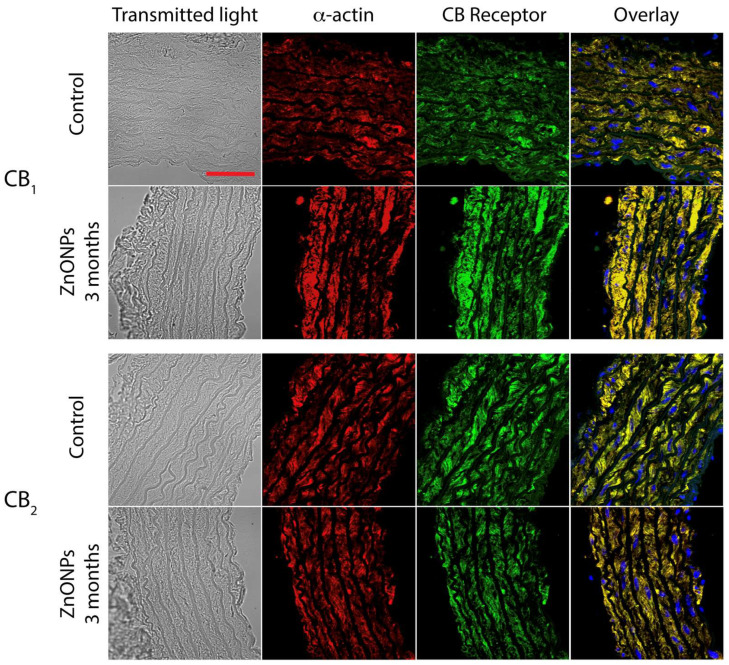 Representative images showed ZnONPs effect on CB1 and CB2 receptors expression in aorta wall. Transmitted light images (grey). Scale bar corresponds to 50 μm. Smooth muscle α-actin was detected with a specific antibody labeled with Alexa Fluor 568 (red). CB1 and CB2 located on the aorta ring were detected by specific antibodies and labeled with FITC (green). Image overlap indicates a high degree of colocalization of CB1 or CB2, and smooth muscle α-actin (yellow). Nuclei were counterstained with DAPI dye (blue).