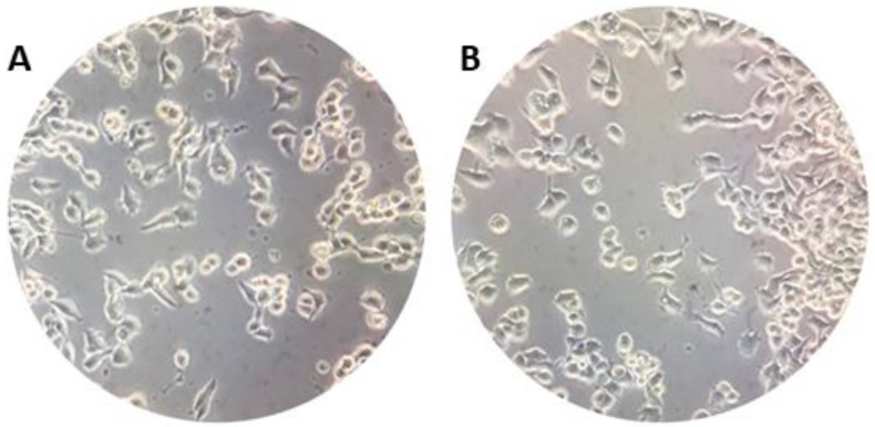 (A) NSC-34 control cells and (B) 10 µM CBNR-treated cells. Objective 40×.