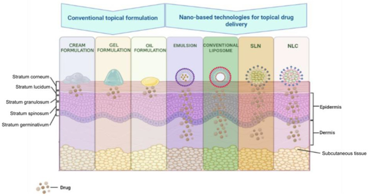 The passage of substances through the layers of the skin depending on the way they are formulated. SLN, solid lipid nanoparticles; NLC, nanostructured lipid carriers.