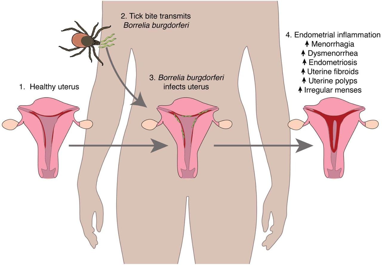Overall model of gynecological pathology development following LD exposure.