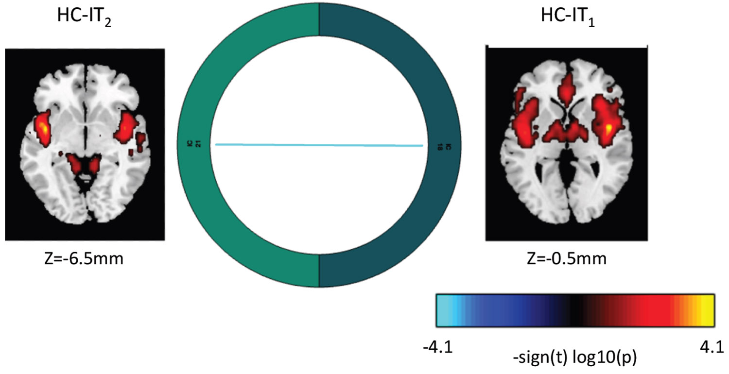 Δ9-Tetrahydrocannabinol (THC) reduced connectivity between an anterior cingulate–dorsal insula component (higher cognition domain–insular temporal subdomain [HC-IT1]) and a ventral insula–lingual gyrus component (HC-IT2) (vs. placebo). THC (vs. placebo) was associated with reduced connectivity between ventral and dorsal portions of the HC-IT network (p < .001, uncorrected).