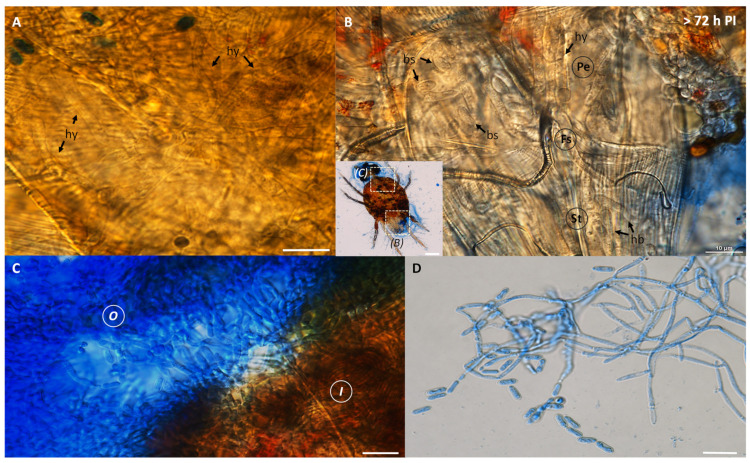 Light micrographs of dead cassava mites at a period longer than 72 h PI. (A) Several hyphae (hy) were observed inside the insect body. (B) A close-up view of anterodorsal section, including the feeding stylets (Fs), peritreme (Pe), and stylophore (St), showed numerous blastospores (bs) and hyphal bodies. (C,D) Dense mycelia and a mass of conidia appeared inside (I) and outside (O) of the hosts. Chains of cylindrical-shaped conidia Metarhizium sp. BCC 4849 were also found at the exterior of the dead host. Bars, 10 µm.