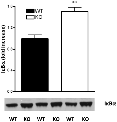 CB2 receptor deficiency is associated with augmented IκBα levels in CLP-induced sepsis.IκBα degradation was assessed using Western blotting of spleen protein extracts of CB2 WT and KO mice. Protein extracts were generated from spleen taken 16 hours after sepsis induction. Bands were detected by enchanced chemiluminescence (ECL). Results (mean±SEM) shown are representative of 3 experiments. **p<0.01 versus WT.