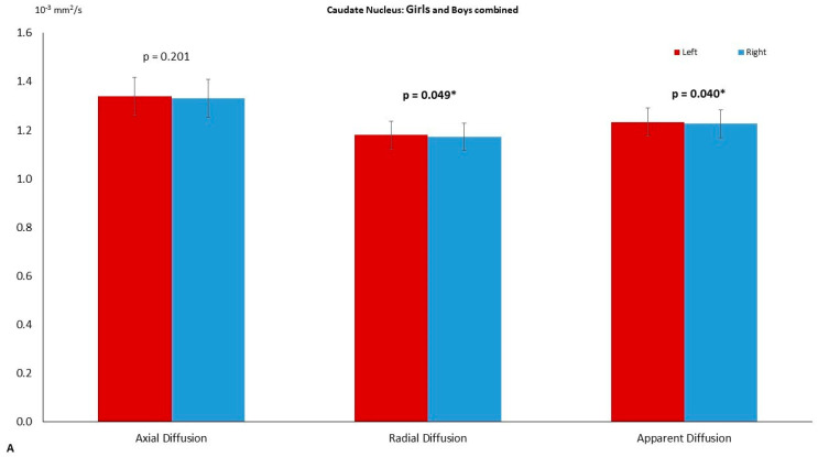 The left–right asymmetry of the caudate-nucleus. (A) The differences on axial diffusion (AD), radial diffusion (RD, p = 0.049) and apparent diffusion coefficient (ADC, p = 0.040) in the combined group (girls and boys). On (B) the asymmetry observed in the boy group with RD (p = 0.043). The significance was set to p = 0.05 and highlighted with a star superscript (*).