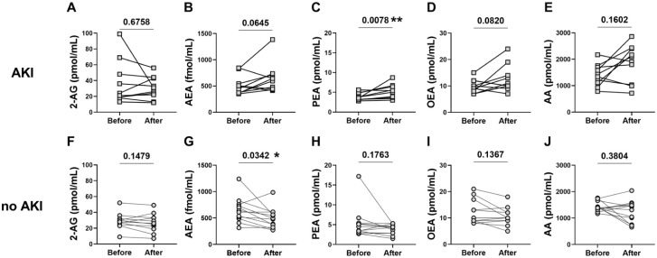 Dynamic changes in serum endocannabinoid and related lipid levels before and after kidney stone drainage. Graphs compare eCBs, PEA, and AA levels in AKI vs. no AKI patients.