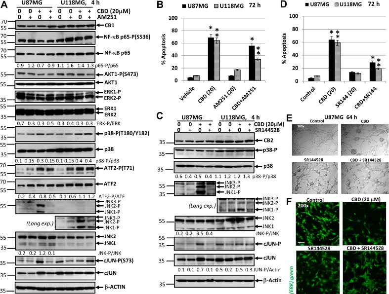 Effects of cannabidiol (CBD) alone or in combination with (i) AM251, an antagonist of CB1-receptor mediated signaling cascades, (ii) SR144528, an antagonist of CB2-receptor mediated signaling cascades, on main signaling pathways and apoptosis in U87MG and U118MG glioblastoma cell lines(A) Effects of AM251 (20 µM), on CBD-induced (20 µM) changes in main signaling pathways were determined in glioblastoma cell lines using Western blot analysis. JNK-P detection is shown on two subpanels with normal (for U87MG) and prolonged exposure (for U118MG) of X-ray film during ECL. Quantitative densitometry of protein bands was performed. (B) Effects of AM251 (20 µM), on CBD-induced (20 µM) apoptosis in glioblastoma lines. Vehicle contains 0.2% DMSO. Cell cycle-apoptosis analysis was performed using PI staining DNA and the flow cytometry. The pooled results of four independent experiments are presented on the upper panel. Error bars represent means ± S.D. (p < 0.05, Student’s t-test). Stars indicate a significant difference between (CBD+Vehicle)- and (CBD+AM251)-treated U87MG cells; double stars -- between (CBD+Vehicle)- and (CBD+AM251)-treated U118MG cells. (C) Effects of SR144528 (20 µM), on CBD-induced (20 µM) changes in main signaling pathways were determined in glioblastoma cell lines using Western blot analysis. Quantitative densitometry of protein bands was performed. (D) Effects of SR144528 (20 µM), on CBD-induced (20 µM) apoptosis was determined 72 h after treatment. (E) Phase-contrast microscopy of U87MG cells 64 h after indicated treatment: control, DMSO 0.2%; CBD 20 µM; SR144528 20 µM; and combination of (CBD+SR144528). Typical images are shown. (F) Immunostaining total ERK (green) and fluorescent microscopy of U87MG cells 64 h after indicated treatment. Typical images are shown. Bar = 50 μm.
