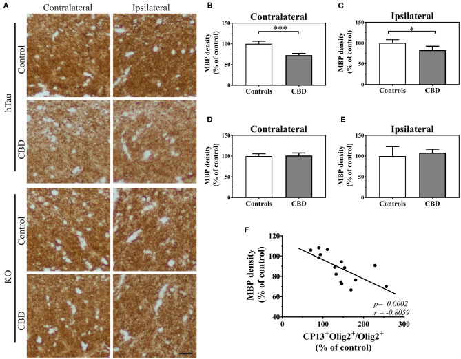 The functional changes in oligodendrocytes triggered by CBD-tau inoculation. (A), the corpus callosum microphotography pictures of myelin basic protein (MBP) immunoreactivity in the contralateral (left panel) and ipsilateral (right panel) sides in hTau (upper panel) or KO (lower panel) animals 12 months after control-tau (upper subpanel) or CBD-tau (lower sub panel) injection. The scale bar represents 25 μm and applies to all pictures. (B–E), The quantitative analysis of densitometric data of MBP immunoreactivity in the corpus callosum of hTau animals contralateral (B, controls n = 4, CBD n = 4) and ipsilateral (C, controls n = 4, CBD n = 4) hemispheres; and KO animals contralateral (D, controls n = 3, CBD n = 4) and ipsilateral (E, controls n = 3, CBD n = 4) hemispheres. The significant decrease in MBP densitometry was observed bilaterally only in hTau animals, reflecting presence of tau-dependent changes. (F), correlation of MBP density and double-positive oligodendrocytes in the corpus callosum. The presence of significant positive correlation indicates functional changes in oligodendrocytes upon tau pathology presence. Comparison between two groups was performed using the Student t test. Spearman's rank correlation coefficient was used to analyze dependence between two sets of data. P-value < 0.05 was considered statistically significant. *P < 0.05, ***P < 0.0001.