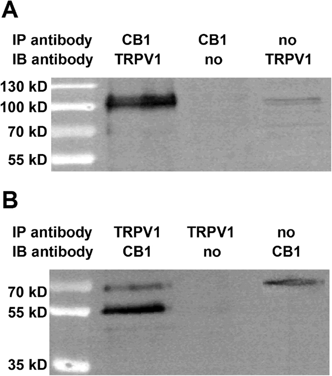 TRPV1 and the CB1 receptor are engaged in PSN.Immunoblots showing TRPV1/CB1 receptor heteromers in the rat DRG. Whole cell lysates were prepared from DRG and immunoprecipitation assays using anti-CB1 (A) and anti-TRPV1 (B) antibodies were carried out as detailed in Materials and Methods. The resulting immune complexes were analysed by immunoblotting using anti-TRPV1 (A) and anti-CB1 (B) antibodies. Immunoprecipitating antibodies and immunoblotting antibodies were omitted from positive and negative controls, respectively. TRPV1 was detected as a ~100 kDa band, while the CB1 receptor was detected as a doublet with molecular weight ~55 and ~63 kDa in the immunoprecipitated samples.