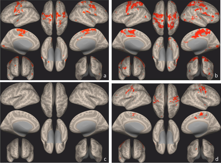 Seed-to-Voxel statistically significant clusters maps using precentral and postcentral gyrus as a seed ROIs, according to responder status. Pre (a) and Post (b) condition in Sativex® non responders and Pre (c) and Post (d) condition in responders. Results are visualized as clusters on inflated brain (p < 0.05, FDR corrected). In post condition (b), there is an increase in connectivity in pre and post central gyrus compared to the pre-condition in non-responders. Same condition is evident in responders (c, d), despite in pre-condition (c) there are no significant clusters