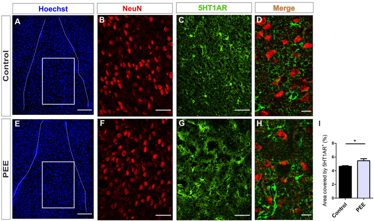 5HT1A receptor expression is altered in the amygdala of PEE adults. Images of coronal sections of adult male mouse brains with Hoechst staining (A,E), immunofluorescence for NeuN (B,F), 5HT1AR (C,G), and merge (D,H) taken on an inverted microscope with a SDU. Sections at the level of the amygdala of a Control (A–D) and PEE brain (E–H). Area covered by 5HT1AR+ measured in the fields delimited by boxes (%, I). Data expressed as the mean ± SEM (Control n = 4 each one from four different control litters, PEE n = 3 each one from three different ethanol PEE litters); all parameters were analyzed by Student’s t-test (*p < 0.05). Scale bar: 150 μm (A,E), 50 μm (B,C,F,G), and 15 μm (D,H).