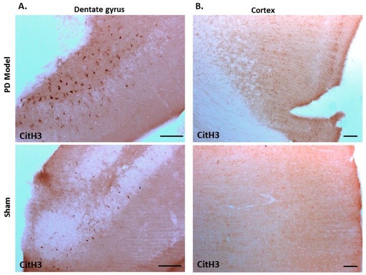 Deiminated histone H3 staining is increased in the cortex and dentate gyrus of pre-motor PD models. Immunohistochemical staining showed increased protein detection of deiminated histone H3 (citH3) in: (A)) the dentate gyrus; (B) the cortex of the pre-motor PD models, compared with those in the control sham animals. The scale bars indicate 100 µm in all figures.