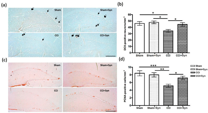 Effect of CCI and synaptamide treatment on hippocampal neurogenesis. (a) Representative images of proliferating cell nuclear antigen (PCNA+) staining. Scale bar: 100 μm. (b) Histogram showing the changes in the number of PCNA+ cells in the dentate gyrus subgranular zone (DG SGZ). (c) Representative images of doublecortin+ staining. Scale bar: 100 μm. (d) Histogram showing the changes in the number of immature neurons (by doublecortin) in the DG SGZ. Mean ± SEM, n = 20 (number of slices per group), * p < 0.05, ** p < 0.01, *** p < 0.001.
