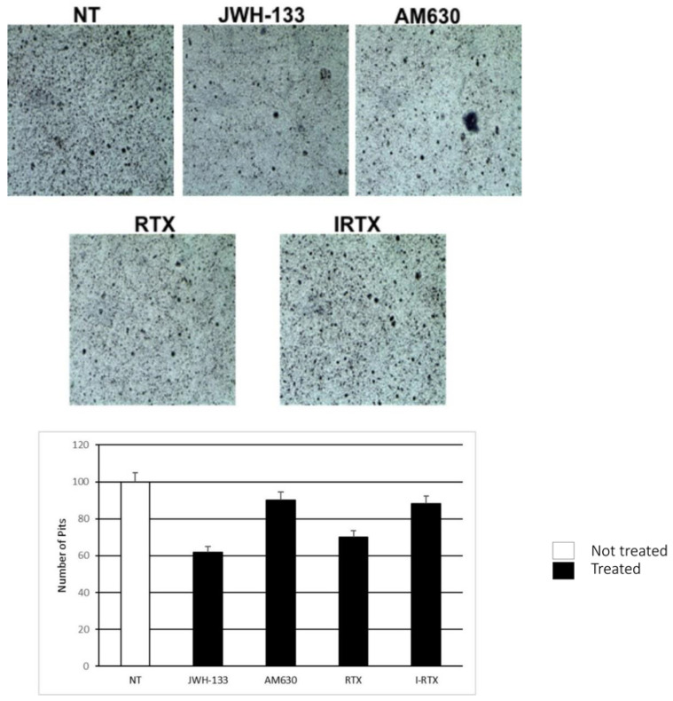 Comparison of bone resorption assay, performed on 2 OCs of patients with PBD, in the untreated (NT), JWH-133 AM630, RTX and IRTX treated samples. The most representative images are displayed. The percentage number of reabsorption pits is presented in histograms as mean ± SD.