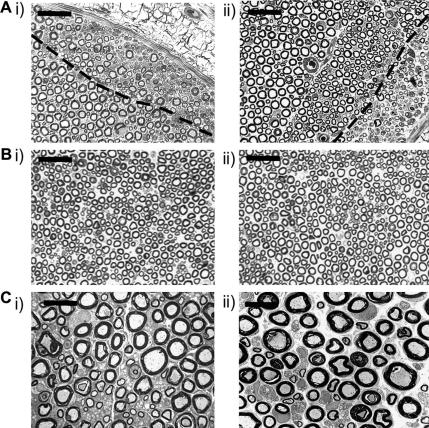 Effects of perineural treatment with RSA or HIV-1 gp120 on the integrity of axons in the sciatic nerve. (A–B) Toluidine blue-stained resin sections (1 μm) from the site of application via an oxycellulose wrap of (i) RSA and (ii) HIV-1 gp120 to the sciatic nerve on day 14 post treatment. (A) Examples of the sciatic nerve highlighting small areas of damage which occurred in the perineural window of the nerve. The broken line demarcates the area of morphologically normal nerve from the damaged area. Scale bar = 20 μm. (B) Examples of nerve in which axons appear undisturbed. (C) Examples of ultrathin sections of nerve within 1cm distal to the site of application of (i) RSA and (ii) HIV-1 gp120 to the sciatic nerve on day 14 post treatment assessed by EM representing the majority of the nerve where myelinated and unmyelinated axons appear normal. Scale bar = 10 μm.