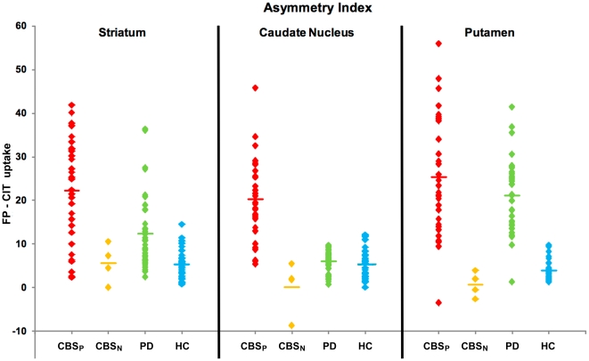 Scatter plots showing hemispheric asymmetry indices in the total striatum, caudate nucleus and putamen in CBSN, CBSP, PD, and HC subjects.