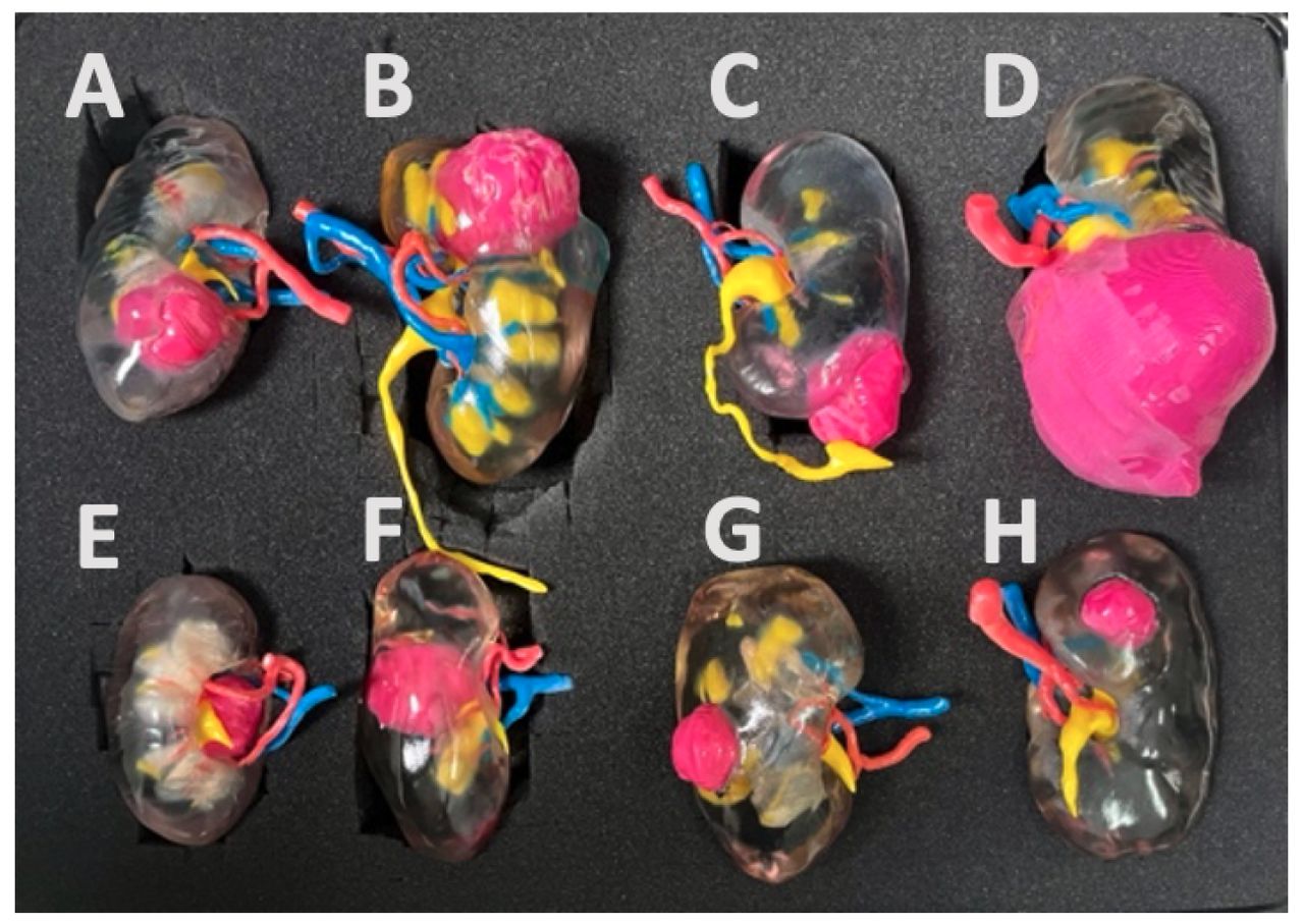 Generic kidney models set (Renal scores [14] according to each kidney : A.8a B.9a C.5a D.10x E.10xh F.11xh G.8p H.5p)