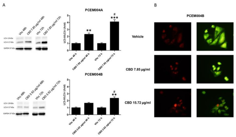 CBD induced autophagy in mixed type I/II EC cell lines. (A) Western blot analysis and densitometric quantification of LC3 protein levels PCEM004a and PCEM004b mixed type EC cell lines treated for up to 72 h with CBD 7.85 µg/mL and 3.92 µg/mL, respectively. Densitometric values, shown as the mean ± SD, were normalized to GAPDH used as loading control. Blots are representative of one of three separate experiments, ** p < 0.01, *** p < 0.001 treated vs. untreated cells, # p < 0.05 72 h vs. 48 h of treatment. (B) Representative image of PCEM004a treated with CBD up to 7.85 µg/mL for 48 h and stained with acridine orange.