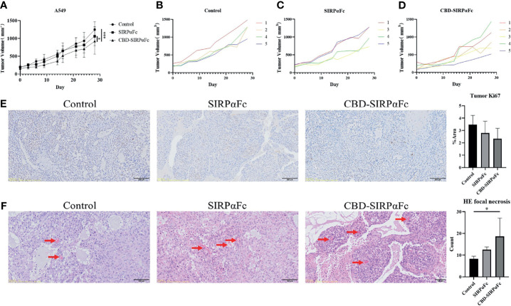 CBD conjugation improved the antitumor efficacy of SIRPαFc in vivo. (A–D) A total of 1 × 107 A549 cells were resuspended in 200 μl PBS then inoculated subcutaneously at the right flank of each BALB/c nude mouse to establish the xenograft model. Mice were administrated intraperitoneally with PBS, 10 mg/kg SIRPαFc, or CBD–SIRPαFc for 28 days. Tumor volumes were measured and analyzed with two-way ANOVA in GraphPad Prism 8 software between groups (n = 5 for the CBD–SIRPαFc group and n = 4 for the control group and SIRPαFc group, mean ± SD, *p < 0.0332, ***p < 0.0002) (A) or in a single group (B–D). One mouse in the control group and one in the SIRPαFc group died before the terminal. (E) Ki67 immunohistochemistry staining was performed to study the proliferation in tumor. Tumors in the control group showed a more severe trend of proliferation than the SIRPαFc and CBD–SIRPαFc group. Proportions of the positive area were counted by ImageJ software and analyzed by one-way ANOVA in GraphPad Prism 8 software (n = 5 for the CBD–SIRPαFc group and n = 4 for the control group and SIRPαFc group, mean + SD). (F) Hematoxylin–eosin (H-E) staining was performed to study the necrosis in tumors. Focal necrosis indicated by red arrows were more and larger in the SIRPαFc and CBD–SIRPαFc group than in the control group. Focal necrosis in all samples was counted and analyzed by one-way ANOVA in GraphPad Prism 8 software (n = 5 for the CBD–SIRPαFc group and n = 4 for the control group and SIRPαFc group, mean + SD, *p < 0.0332).