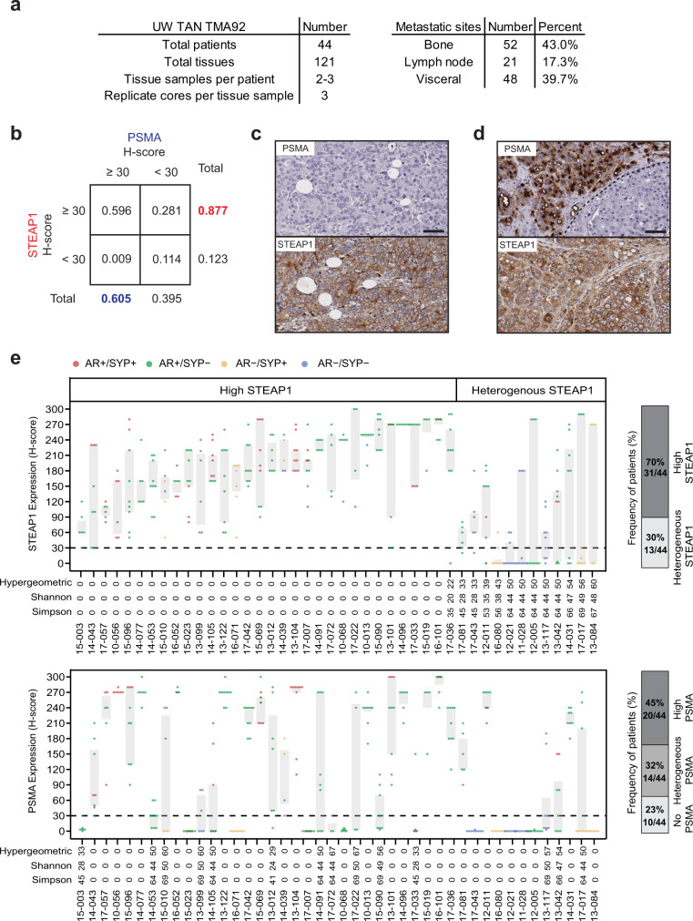 Comparative analysis of STEAP1 and PSMA in lethal, metastatic castration-resistant prostate cancer (mCRPC).a Characteristics of the mCRPC tissues represented on University of Washington Tissue Acquisition Necropsy Tissue Microarray 92 (UW TAN TMA92). b Contingency table showing the frequency of mCRPC tissues with STEAP1 or PSMA IHC staining above or below an H-score threshold of 30. Micrographs of select mCRPC tissues after STEAP1 and PSMA IHC staining to highlight the (c) absence of PSMA but presence of STEAP1 expression and (d) intratumoral heterogeneity of PSMA expression but not STEAP1. Scale bars = 50 µm. For panels (c, d) n = 332 mCRPC cores were immunostained for STEAP1 and PSMA. e Dot and box plot showing the distribution of STEAP1 (top) and PSMA (bottom) H-scores in 44 patients from the UW TAN TMA92 cohort. Each dot represents a tumor specimen/core (n = 319 cores for PSMA and 333 cores for STEAP1) and the color indicates the molecular subtype: AR+/SYP+ (red), AR+/SYP− (green), AR−/SYP+ (yellow) and AR−/SYP− (purple). Gray rectangles show interquartile ranges spanning the 25th to the 75th percentiles of PSMA H-scores from each patient. Bar plots (on the right) summarize the frequencies of patients classified based on STEAP1 and PSMA expression as no expression (all cores with H-score ≤30, light grey), heterogeneous expression (at least one core with H-score ≤30 and H-score >30, mid grey) and high expression (all cores with H-scores >30, dark grey). Source data are provided in the Source Data file.